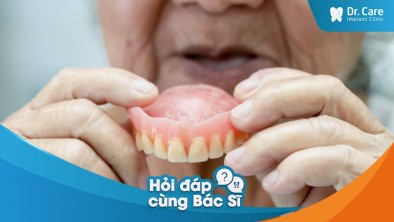  Sau khi trồng răng giả nguyên hàm cần kiêng gì?