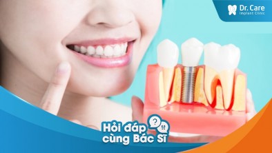 [Hỏi đáp bác sĩ] Cách vệ sinh răng miệng sau khi trồng trụ Implant Thụy Sĩ?