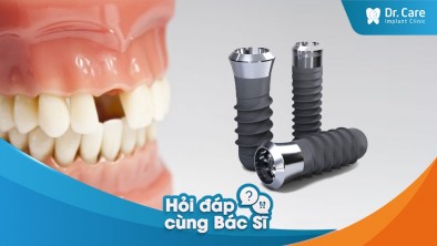 [Hỏi đáp bác sĩ] Mất răng lâu năm và cảm thấy mất tự tin trong cuộc sống hàng ngày. Trồng trụ Implant Thụy Sĩ khôi phục được thẩm mỹ không?