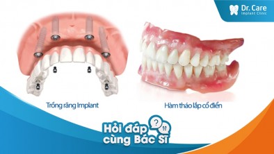 [Hỏi đáp bác sĩ] Mất răng lâu năm dùng hàm tháo lắp có trồng lại bằng Implant Thụy Sĩ được không?
