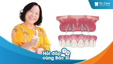 [Hỏi đáp bác sĩ] - Mất răng trồng răng sứ có tiết kiệm không?