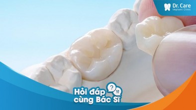 [Hỏi đáp bác sĩ] - Chi phí răng sứ thường và răng sứ cao cấp khác nhau thế nào?