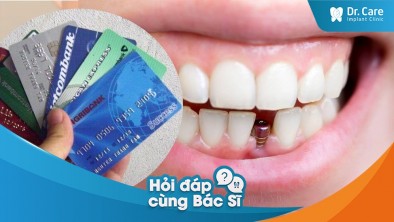 [Hỏi đáp bác sĩ] - Phương thức thanh toán khi trồng răng sứ tiết kiệm trên Implant tại nha khoa Dr. Care?