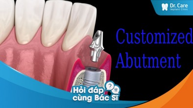 [Hỏi đáp bác sĩ] - Vì sao Customized Abutment có thể sử dụng ở nhiều vị trí mất răng?