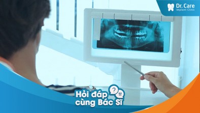 [Hỏi đáp bác sĩ] - Những loại xét nghiệm nào là quan trọng và bắt buộc trước khi trồng răng Implant?