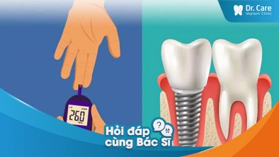 [Hỏi đáp bác sĩ] - Kiểm soát lượng đường trong máu ra sao trước khi trồng răng Implant đối với trường hợp tiểu đường?