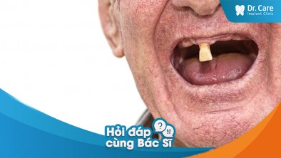[Hỏi đáp bác sĩ] - Tại sao mất răng lại phổ biến ở người cao tuổi?