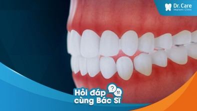 [Hỏi đáp bác sĩ] - Làm thế nào để chăm sóc răng và nướu sau khi mất răng?