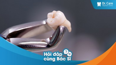 [Hỏi đáp bác sĩ] - Có thể làm gì để giữ răng còn lại của mình khỏe mạnh sau khi mất răng?