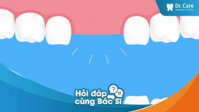 [Hỏi đáp bác sĩ] - Tác động của việc mất răng đối với khả năng phát âm là gì?
