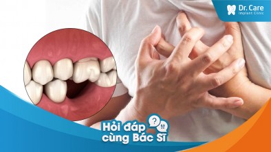 [Hỏi đáp bác sĩ] - Việc mất răng có ảnh hưởng đến tỷ lệ mắc bệnh tim mạch không?