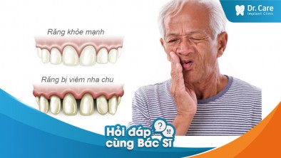 [Hỏi đáp bác sĩ] - Mất răng và viêm nha chu có liên quan lẫn nhau ra sao?