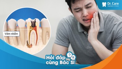 [Hỏi đáp bác sĩ] - Có những triệu chứng nào khác của sâu răng mà tôi nên chú ý không?