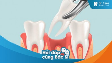 [Hỏi đáp bác sĩ] - Mất răng có ảnh hưởng đến nguy cơ mắc viêm nha chu trong tương lai không? 