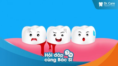 [Hỏi đáp bác sĩ] - Có nguyên nhân nào chung giữa mất răng và viêm nha chu không?