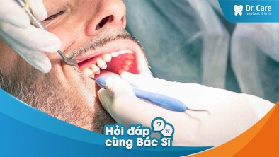 [Hỏi đáp bác sĩ] - Làm cách nào cải thiện sức khỏe nướu và xương hàm sau khi mất răng và bị viêm nha chu?