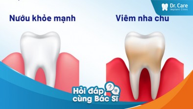 [Hỏi đáp bác sĩ] - Có biện pháp nào để giảm tác động của viêm nha chu sau khi mất răng không?