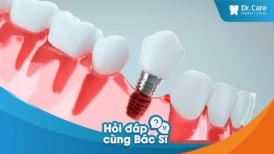 [Hỏi đáp bác sĩ] - Mất răng do viêm nha chu muốn trồng răng Implant thì có yêu cầu quy trình điều trị nào đặc biệt nào không?