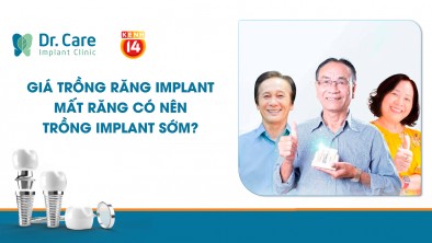 [Kenh14] Giá trồng răng Implant - Mất răng có nên trồng Implant sớm?