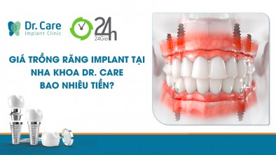 [24h] Giá trồng răng Implant tại nha khoa Dr. Care bao nhiêu tiền?