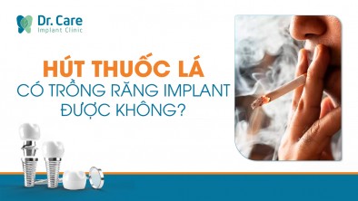 Người hút thuốc lá có trồng răng Implant được không?