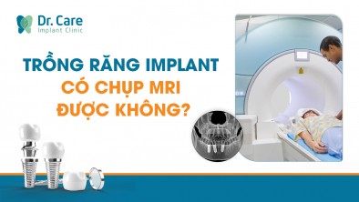 Trồng răng Implant có chụp MRI được không?