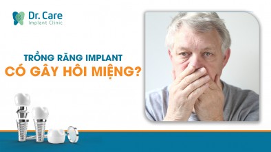[Giải đáp] Trồng răng Implant có bị hôi miệng không?