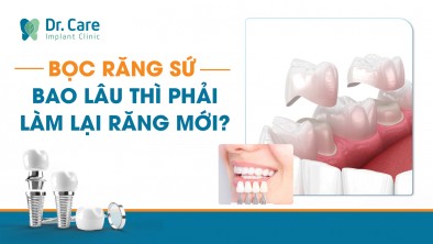 Bọc răng sứ bao lâu thì phải làm lại răng mới?