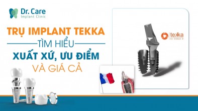 Trụ Implant Tekka - Tìm hiểu xuất xứ, ưu điểm và giá cả