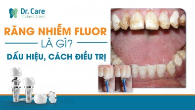 Răng nhiễm fluor là gì? Dấu hiệu và cách điều trị