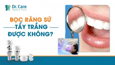 Bọc răng sứ có tẩy trắng được không?