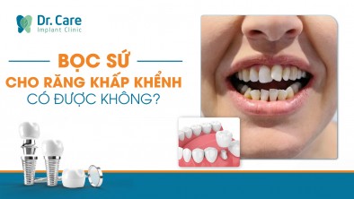 [CHI TIẾT] - Bọc sứ cho răng khấp khểnh có được không?