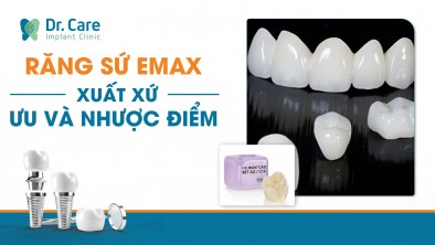 Răng sứ Emax - Tìm hiểu xuất xứ, ưu và nhược điểm