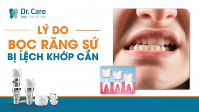 Lý do bọc răng sứ bị lệch khớp cắn là gì? Cách khắc phục hiệu quả