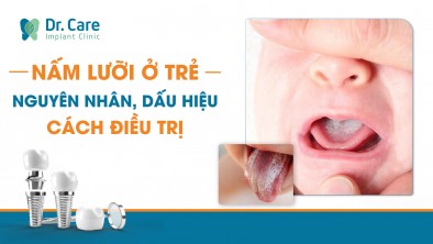 Nấm lưỡi ở trẻ em: Nguyên nhân, dấu hiệu và cách điều trị