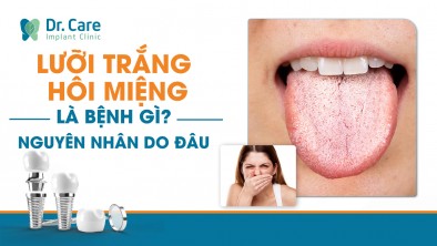 Lưỡi trắng hôi miệng là bệnh gì? Đâu là nguyên nhân và cách điều trị