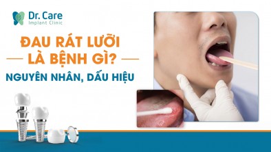 Đau rát lưỡi là bệnh gì? Nguyên nhân, dấu hiệu và cách nhận biết