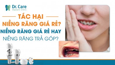 Tác hại niềng răng giá rẻ? Nên niềng răng giá rẻ hay niềng răng trả góp?