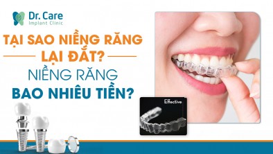 Tại sao niềng răng lại đắt? Nên chọn niềng răng giá rẻ hay trồng răng Implant trả góp