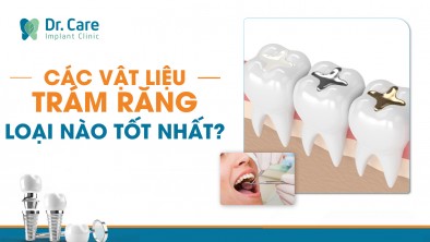 Các vật liệu trám răng hiện nay. Loại nào tốt nhất?