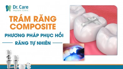 Trám răng composite – Phương pháp phục hồi răng tự nhiên