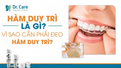 Hàm duy trì là gì? Vì sao cần phải đeo hàm duy trì?