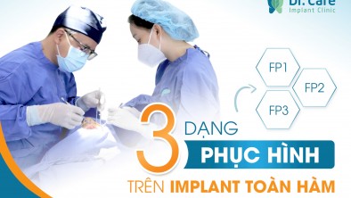 [Hỏi đáp bác sĩ] - Các dạng phục hình răng sứ trên Implant toàn hàm