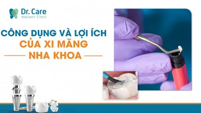 Tìm hiểu về công dụng và lợi ích của xi măng nha khoa