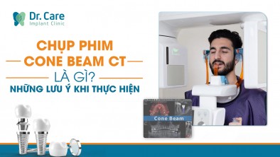 [CHI TIẾT] - Chụp phim Cone Beam CT là gì? Những lưu ý khi chụp phim Cone Beam CT