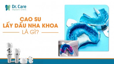 Cao su lấy dấu nha khoa là gì? Có gây nguy hiểm hay khó chịu khi sử dụng không?