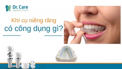 Khí cụ niềng răng có công dụng gì?