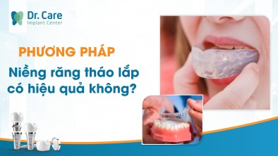  Phương pháp niềng răng tháo lắp có hiệu quả không?