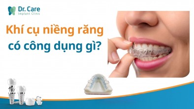 Khí cụ niềng răng có công dụng gì?