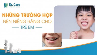 Những trường hợp nên niềng răng cho trẻ em